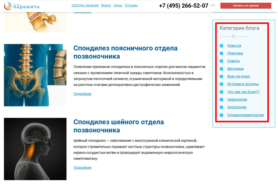 Применение принципа hub-&-spoke для блога сайта